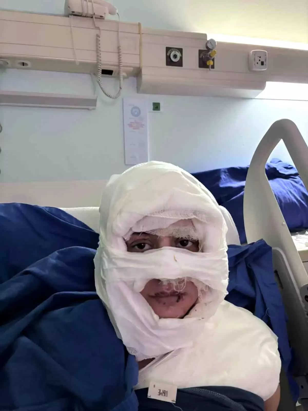 Kadıköy\'de Kadına Ateşli Saldırı