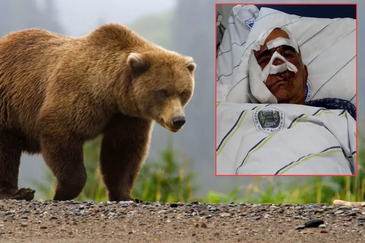 Neye uğradığını şaşırdı! Pençe darbeleri aldı, elmacık kemiği koptu