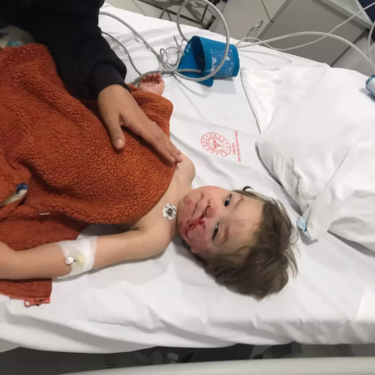 Pitbull Saldırısı: İki Çocuk Yaralandı