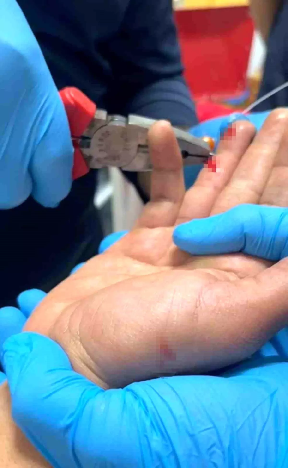 Kahta\'da Balık Avında İğne Faciası