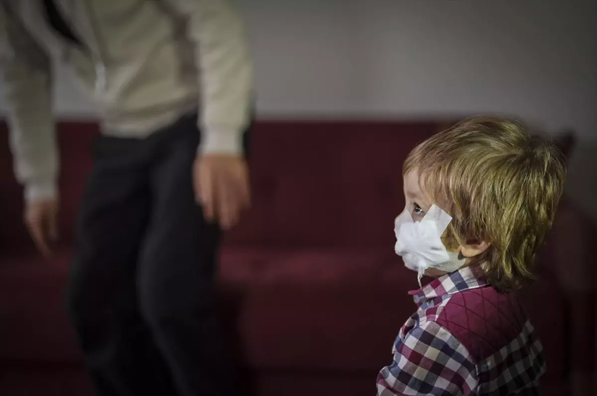 Pitbull Saldırısı: 1,5 Yaşındaki Efe Taburcu Oldu