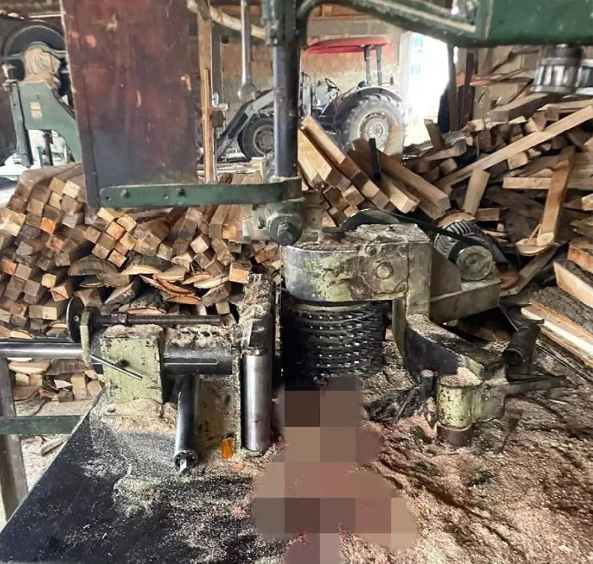 Boyabat\'ta İş Kazası: İşçi Hızar Makinesine Kolunu Kaptırdı