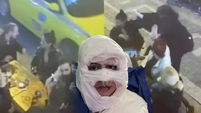 Kadıköy'de genç kadını yanıcı madde döküp yakarak yaralayan sanığa dava Kadıköy'de genç kadını yanıcı madde döküp yakarak yaralayan sanığa dava