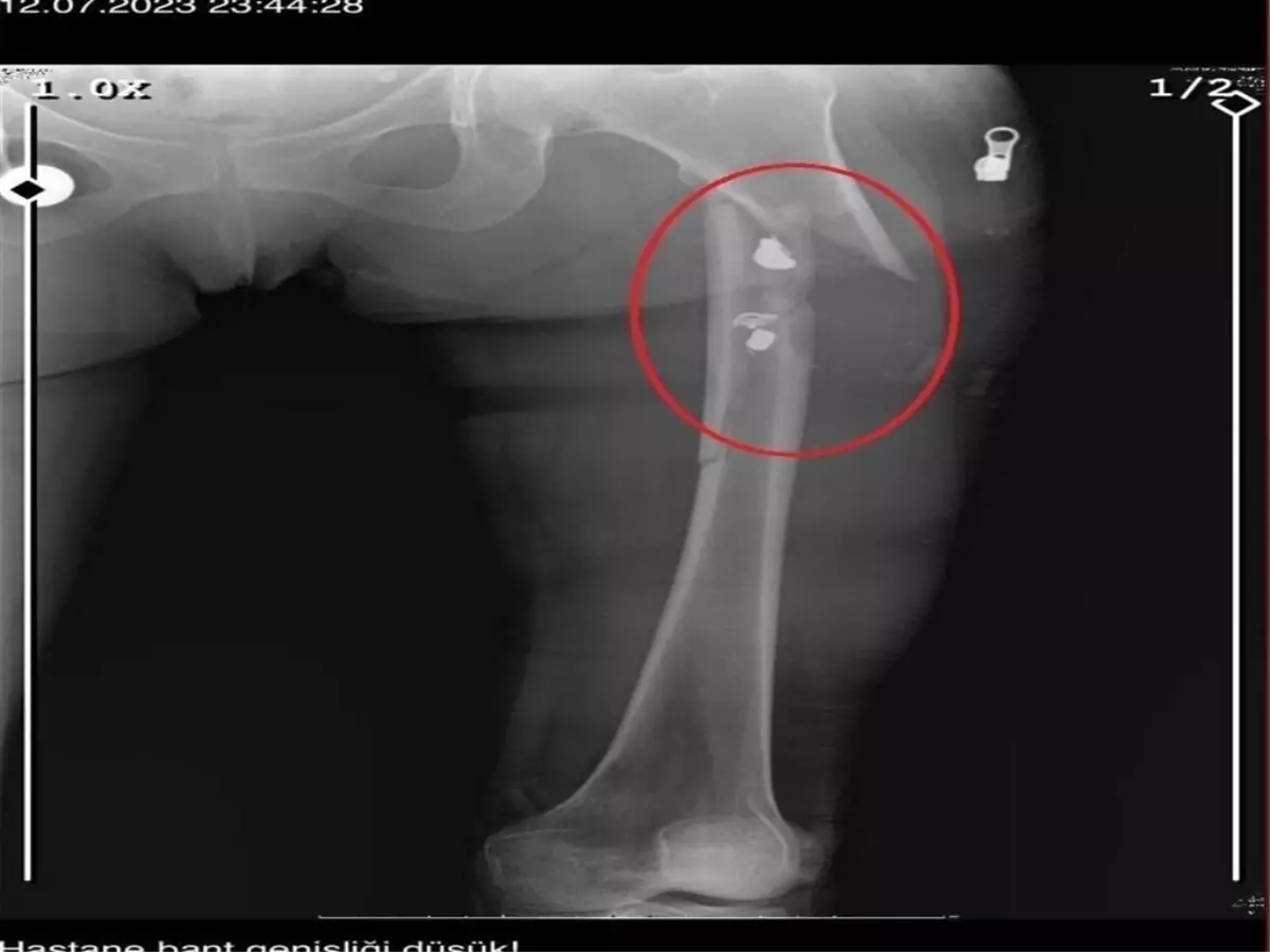 Bursa\'da Cinayet ve Cinsel Saldırı Davası