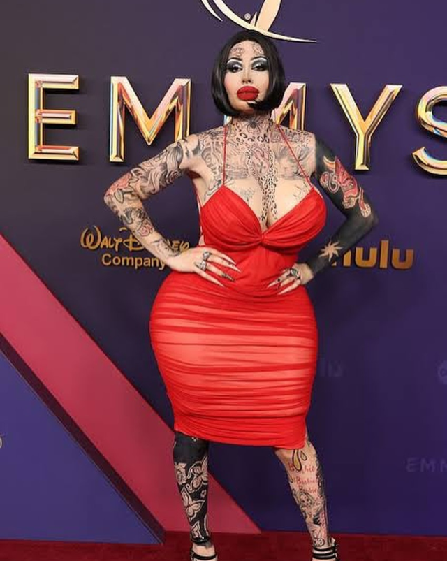 Estetik bağımlısı sosyal medya fenomeninin şüpheli ölümü tartışma yarattı Estetik bağımlısı sosyal medya fenomeninin şüpheli ölümü tartışma yarattı