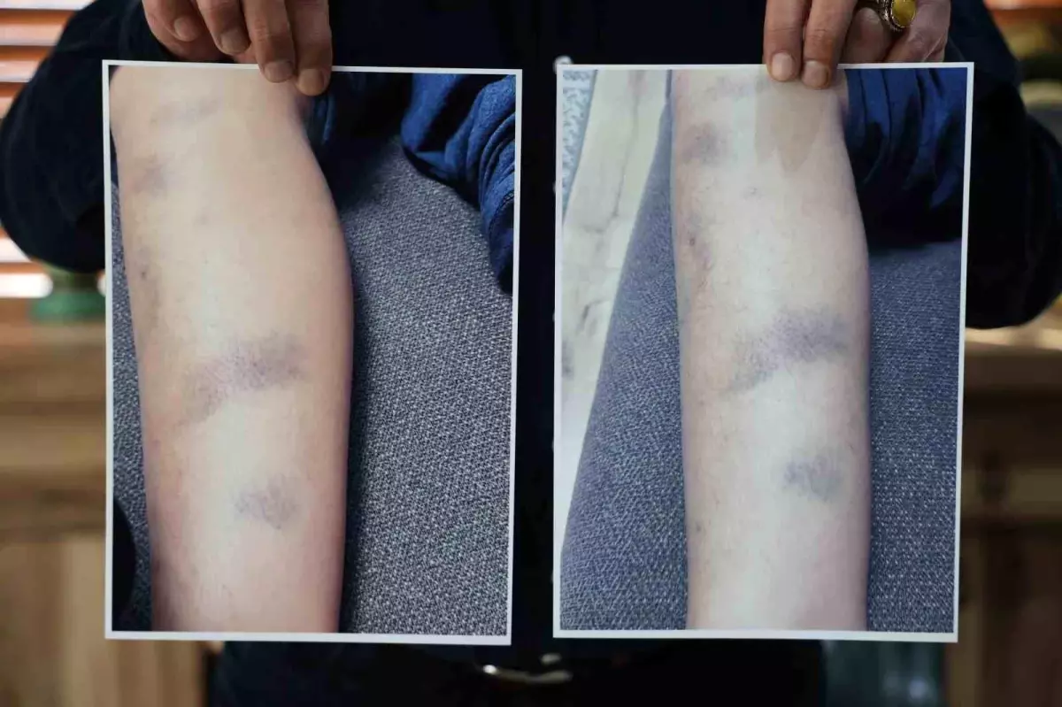 Diyarbakır\'da Okulda Darp İddiası