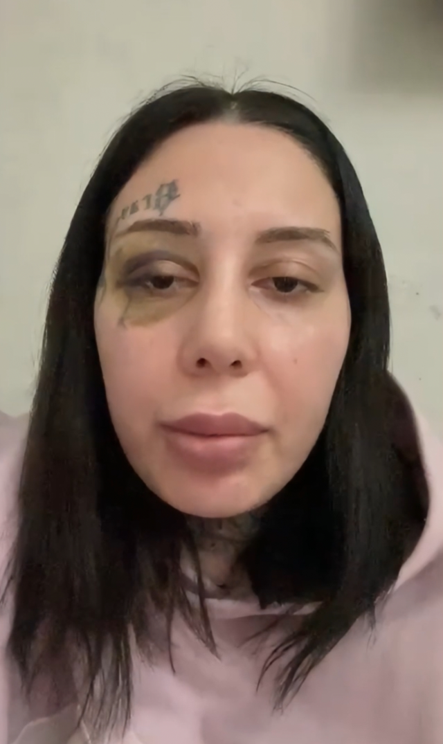 Sokak ortasında vahşet: Tecavüz etti, evlendik, şiddet başladı Sokak ortasında vahşet: Tecavüz etti, evlendik, şiddet başladı