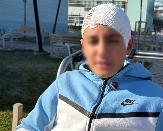 Akran zorbalığına maruz kalan 13 yaşındaki çocuğun kafatası titanyum parçalarıyla yeniden oluşturuldu