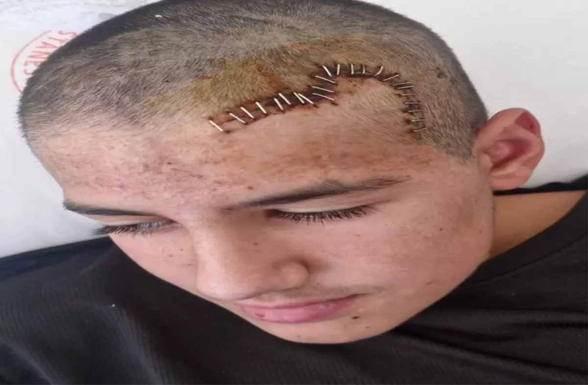 Okul Arkadaşını Yaralayan Çocuk Tekrar Tutuklandı