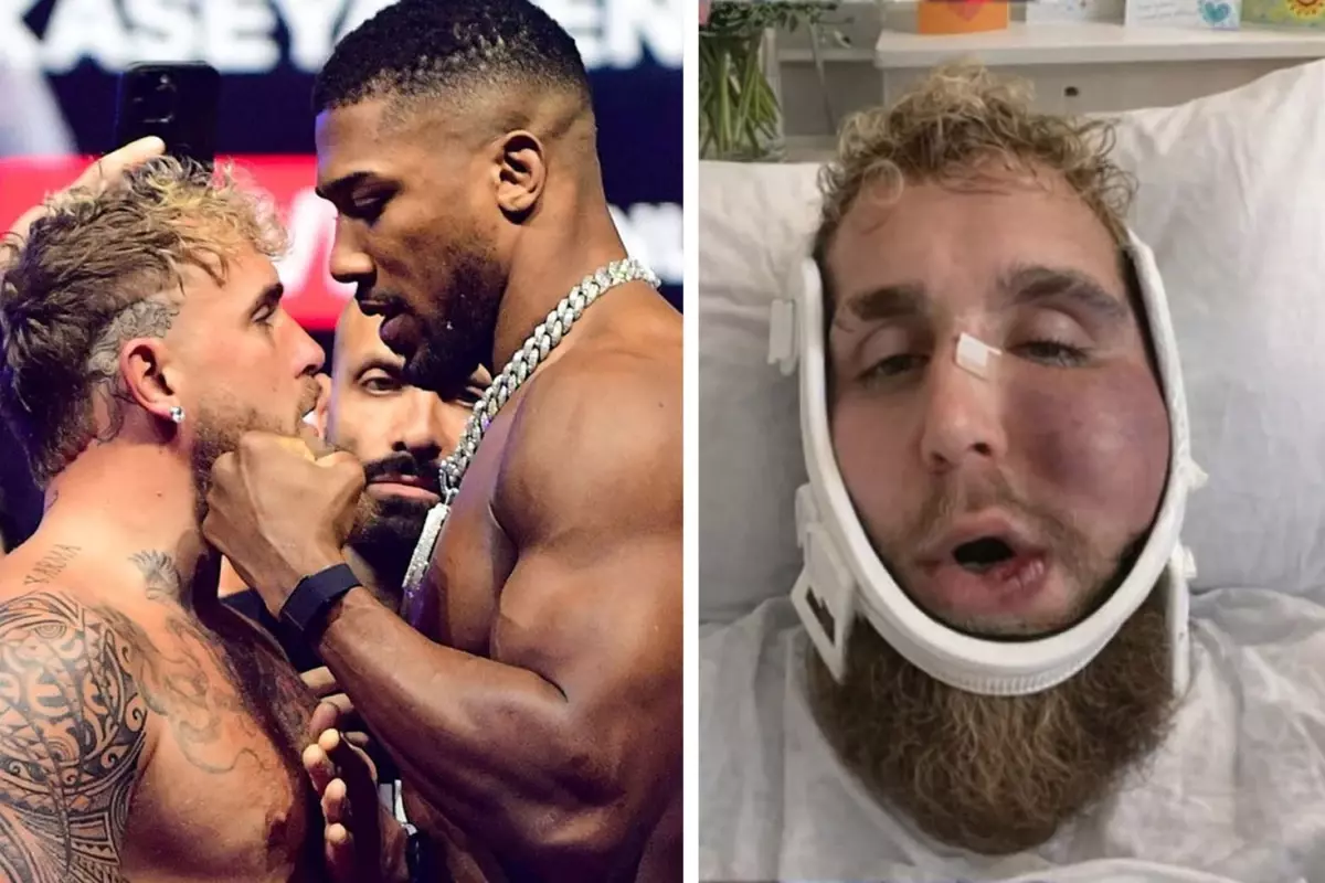 Suratı tanınmaz hale gelen Jake Paul\'un ne kadar kazandığını duyunca şok olacaksınız