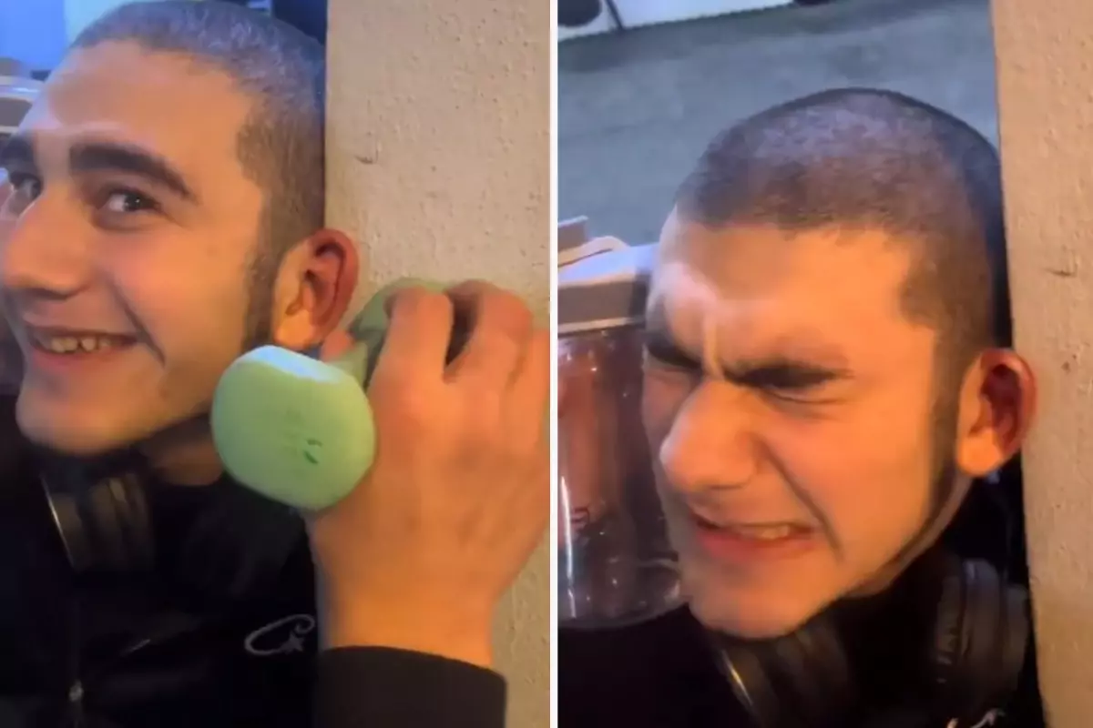 Dövüşçülere benzemek için kulak kıkırdaklarını kırdırdı