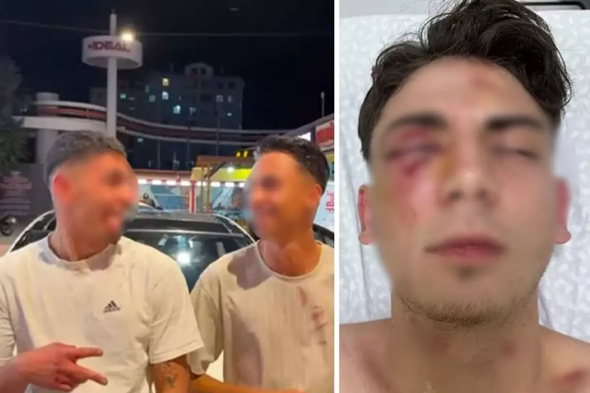 Muştalarla döverek kör ettiler, ellerinde kan ile video çektiler! 1,5 ayda tahliye olan şüpheliler yeniden gözaltında