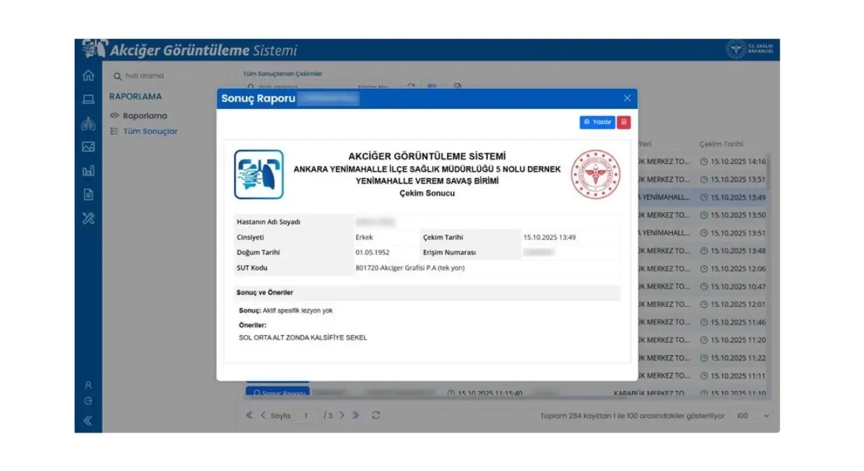 Yeni Akciğer Görüntüleme Sistemi Devreye Girdi