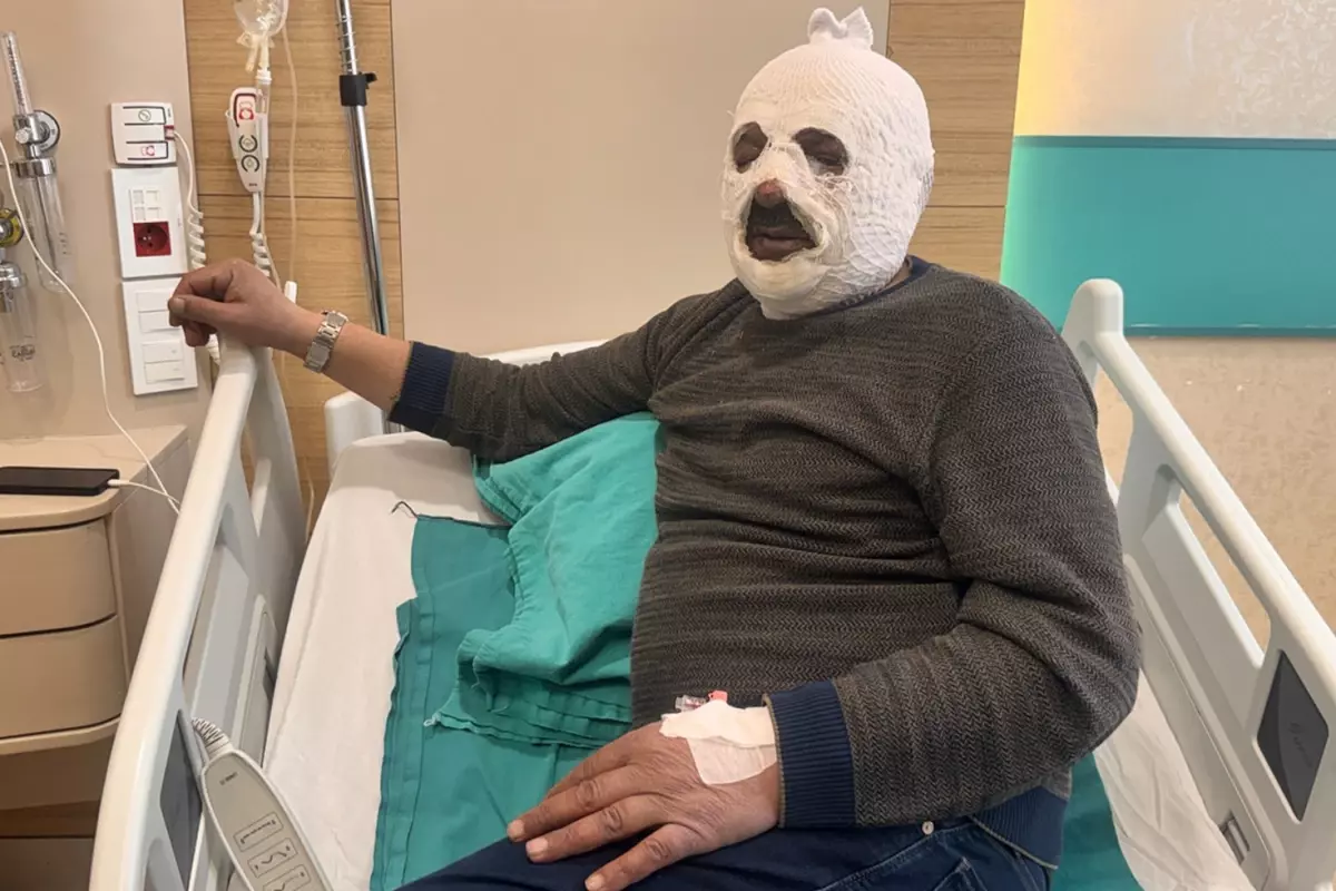 Arkadaşına yardım etmek isterken kabusu yaşadı