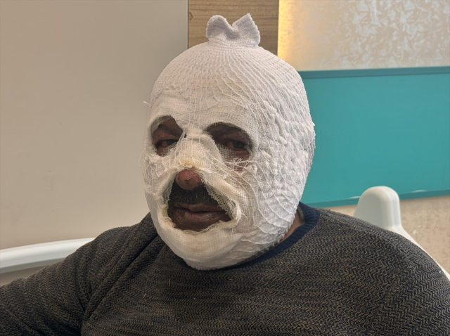 Kalorifer kazanını yakmak için döktüğü benzin az daha canından ediyordu Kalorifer kazanını yakmak için döktüğü benzin az daha canından ediyordu