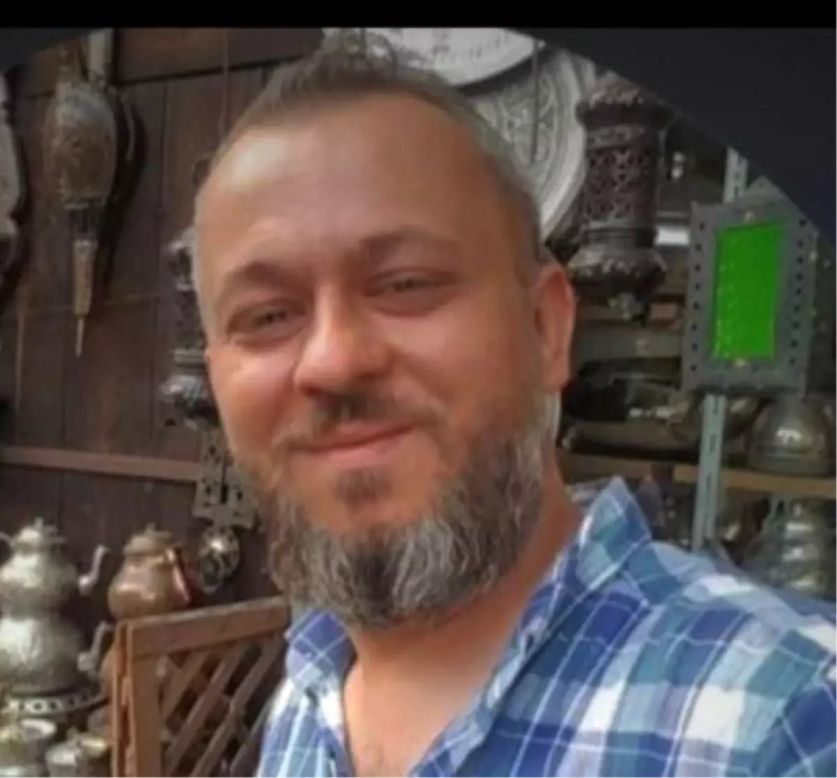 Kocaeli\'de Kaza: Ağır Yaralı İşçi Hayatını Kaybetti