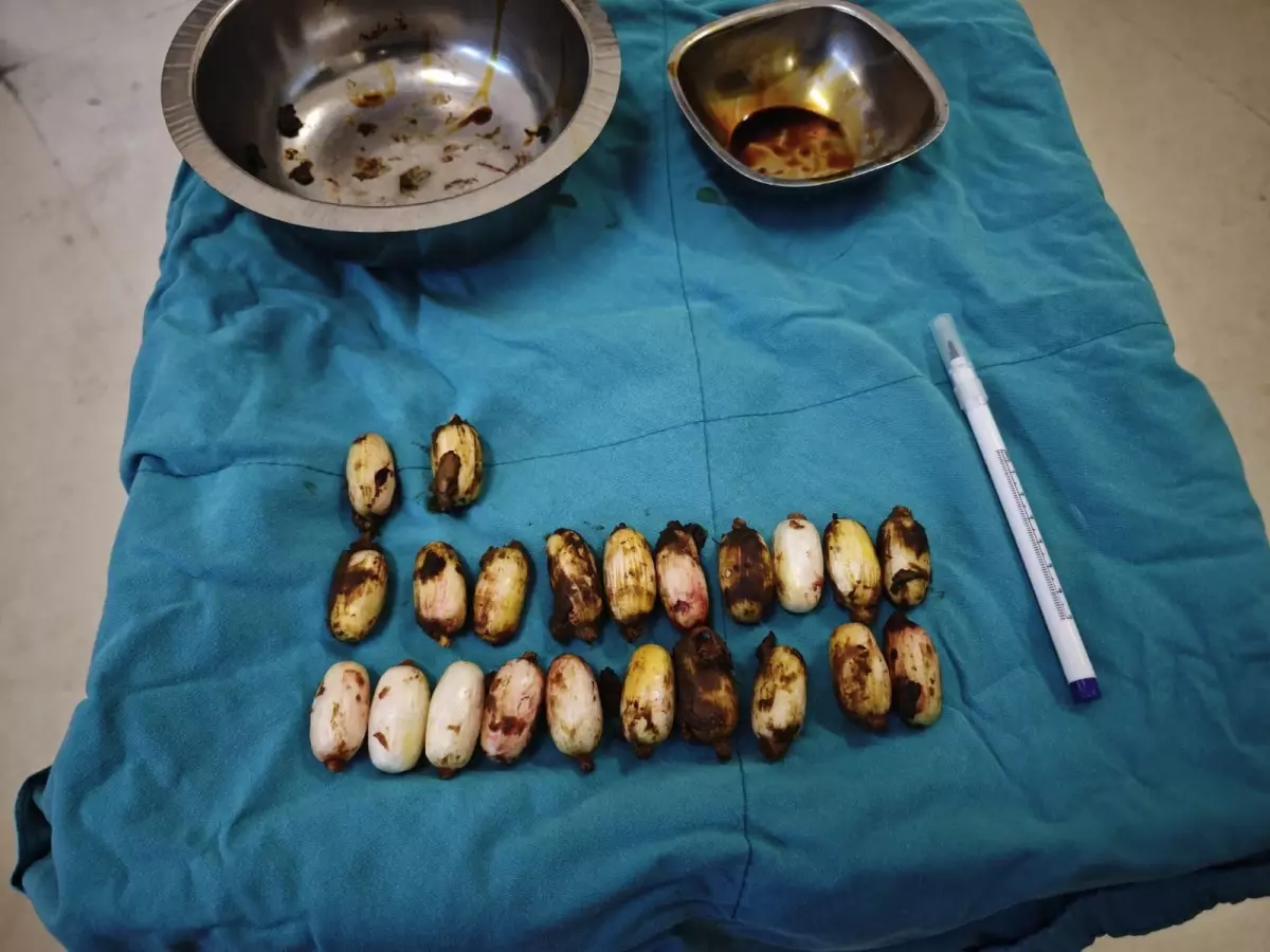 Eskişehir\'de polisin durdurduğu şahsın midesinden çıkanlar şoke etti