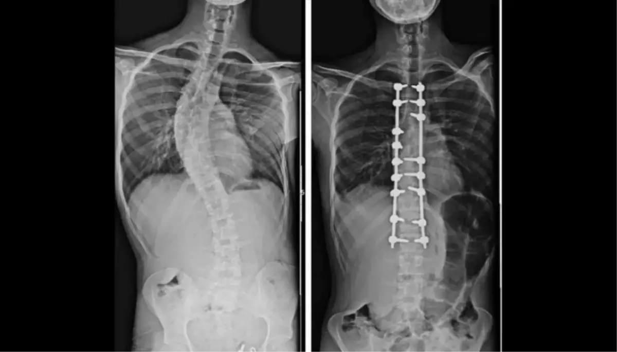 Yapay Zeka ile Ortopedi Devrimi