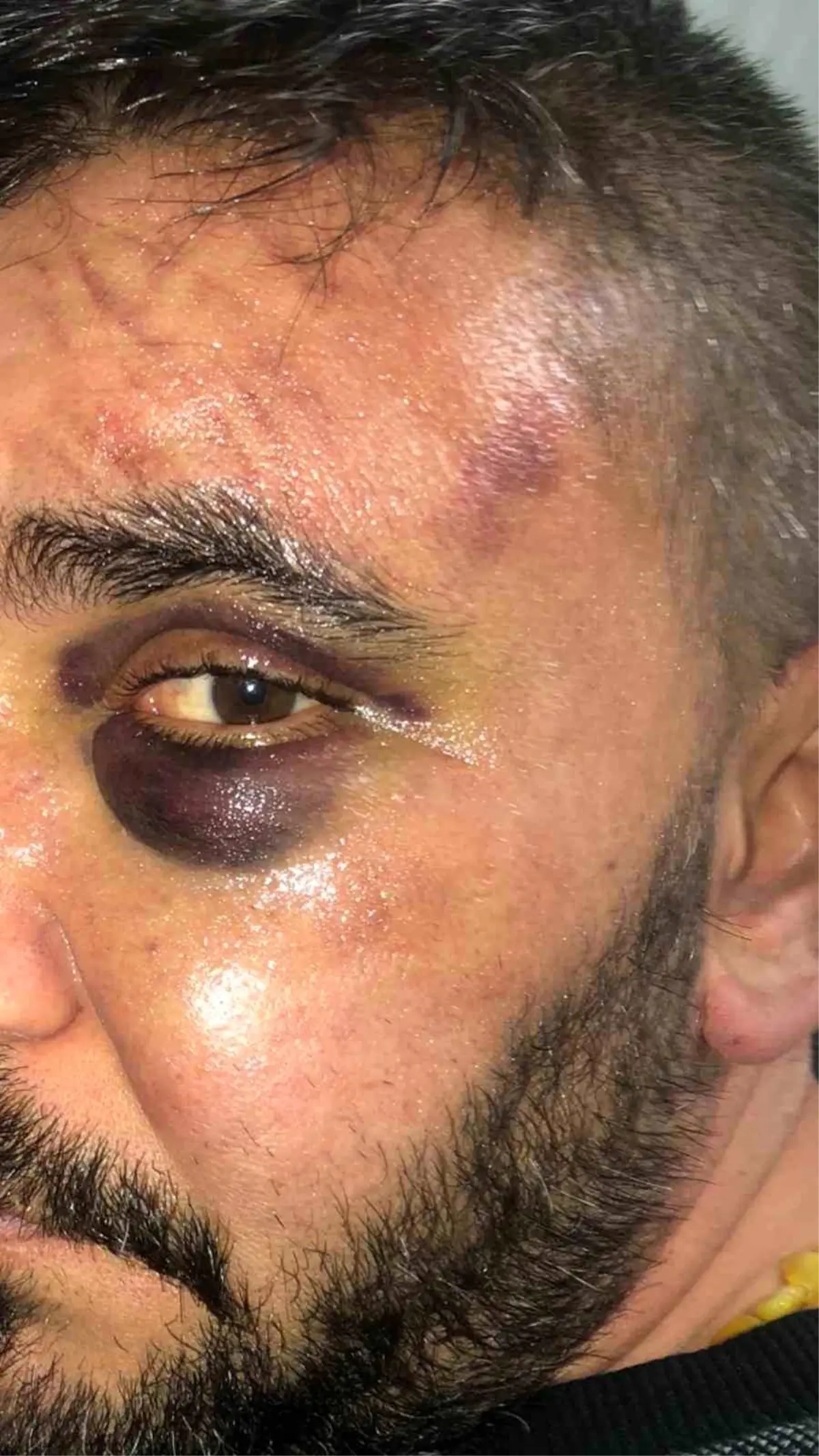 İsyeri sahibi dükkanında öldüresiye darp edildi