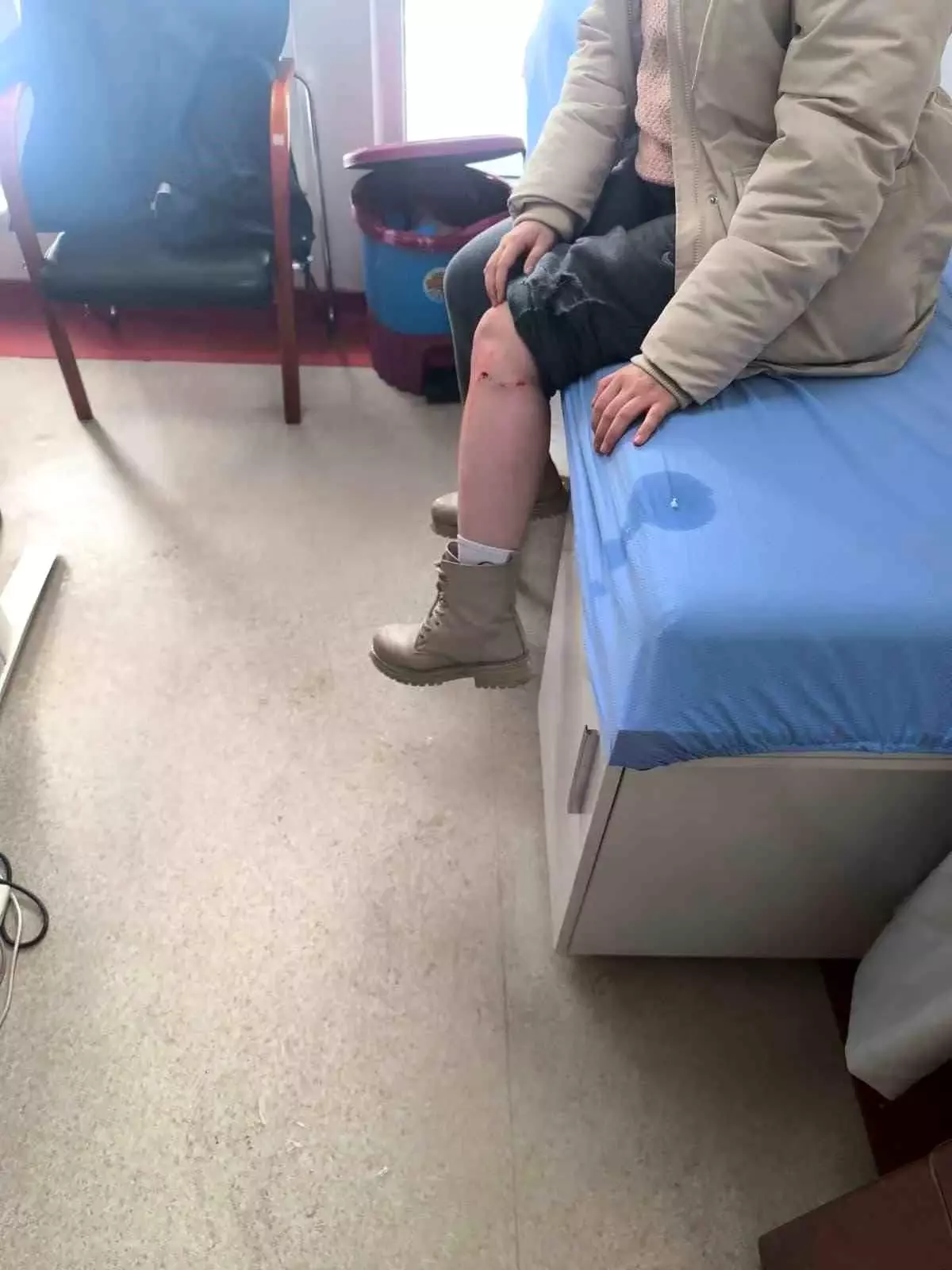 Kayseri\'de Sokak Köpeği Kız Çocuğunu Yaraladı