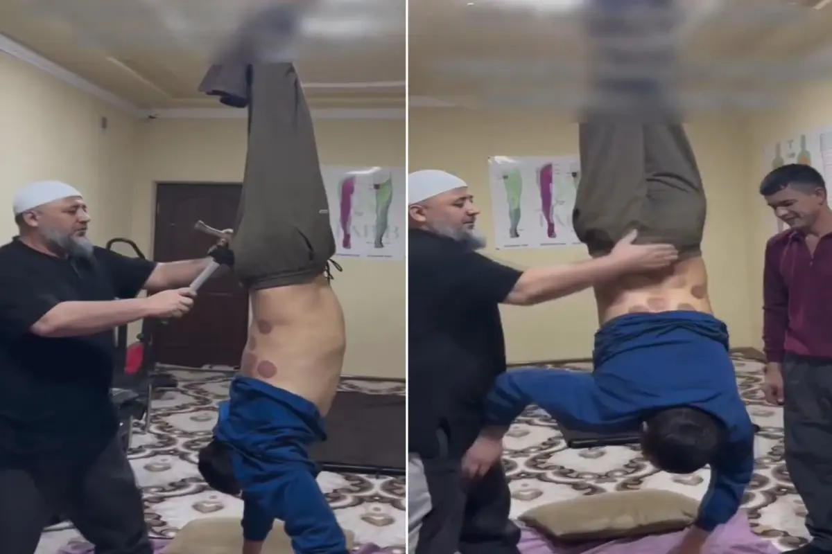 Tedavi değil işkence! Ayaklarından tavana asıp çekiç ve kazıkla...