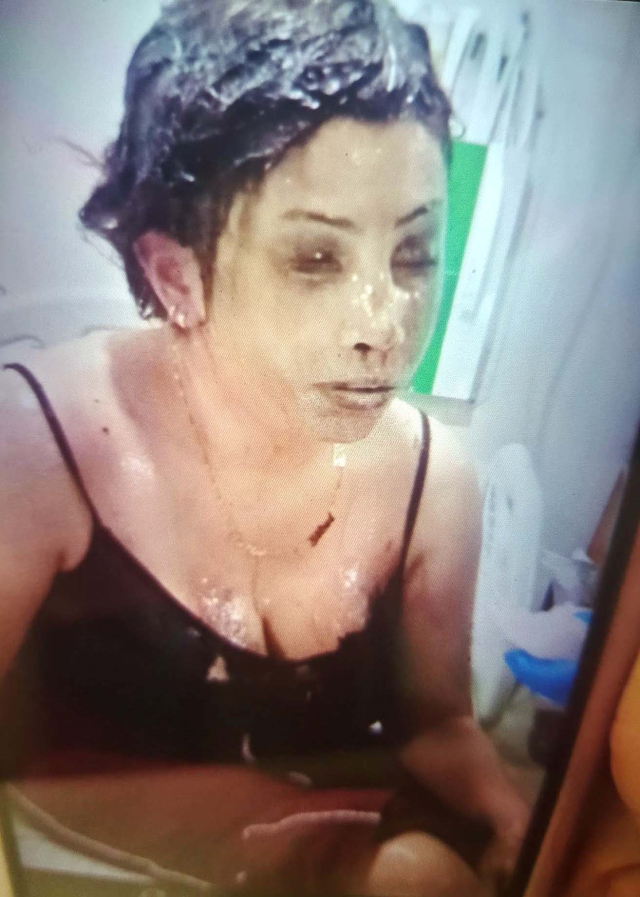 Bunun adı saf kötülük! Eşini koli bandıyla bağlayıp kezzapla yaktı