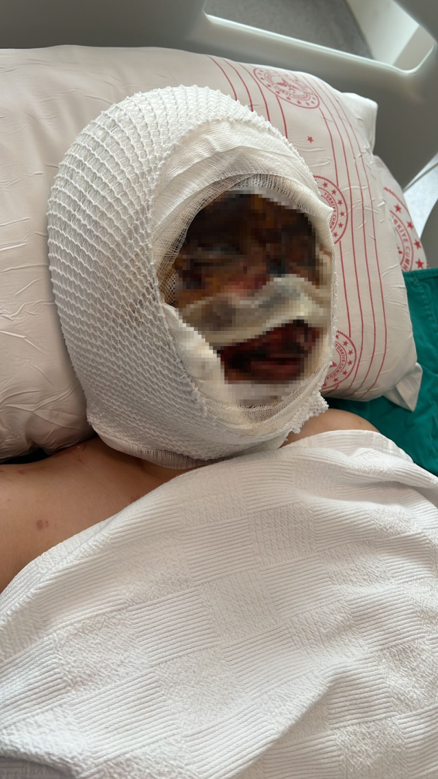 Bunun adı saf kötülük! Eşini koli bandıyla bağlayıp kezzapla yaktı