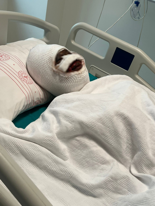 Eski eşini kezzapla ağır yaralayan adam her şeyi önceden planlamış