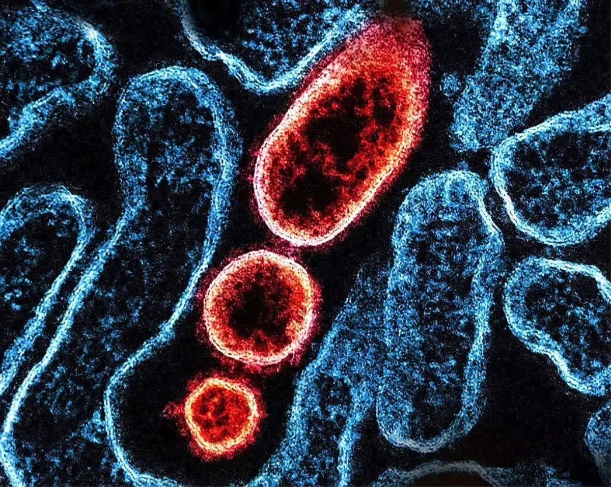 Hindistan\'da Nipah Virüsü Salgını