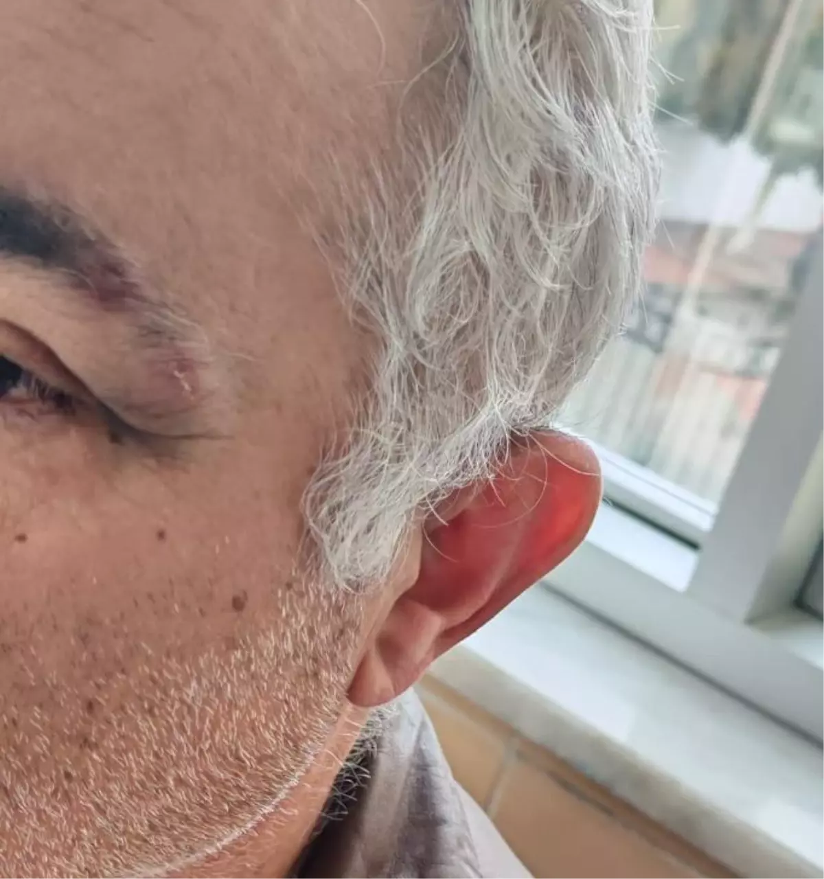 Müezzinin, sıra yüzünden aile hekimini darbettiği iddiası