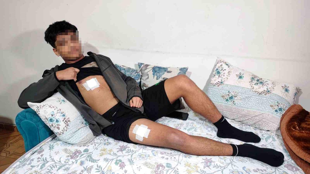 Adana\'da Akran Zorbalığı: 15 Yaşındaki Çocuk Bıçaklandı