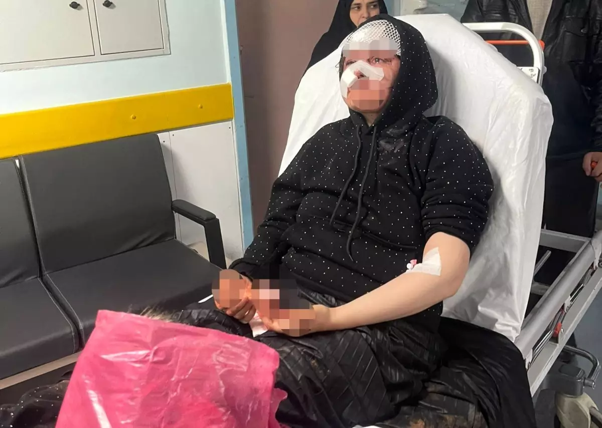 Boşanmak isteyen karısını öldüresiye darp eden koca tutuklandı