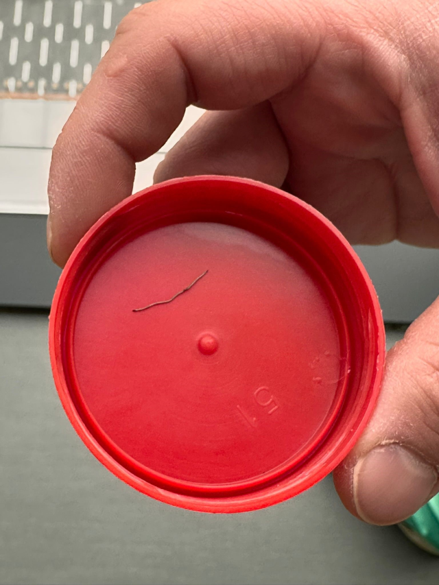 1 yaşındaki bebek sırtüstü yatırıldıkça ağladı! Gerçeği gören aile şoke oldu