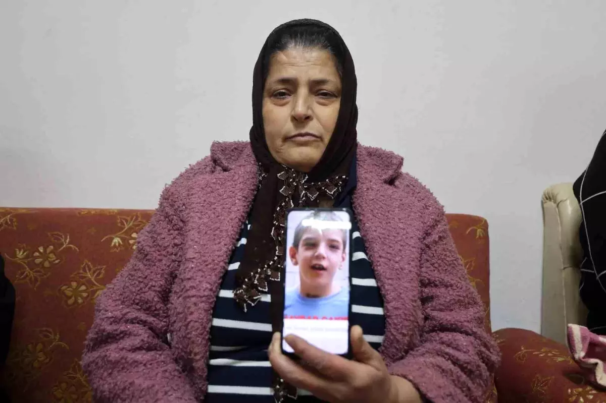 Siyam İkizlerinden Ali Haydar Hayatını Kaybetti