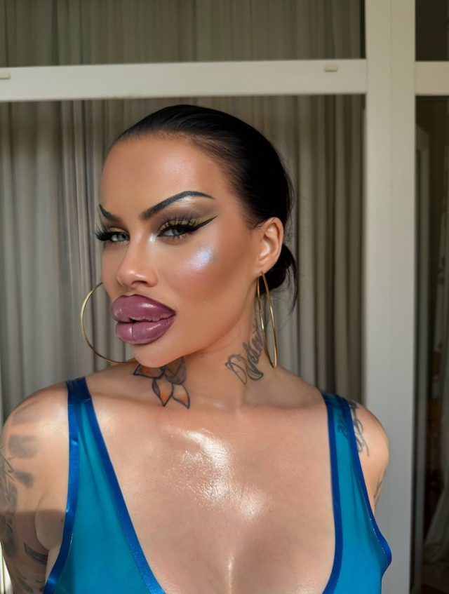 Estetiğe 60 bin dolar harcayan fenomen: Artık ağzımı kapatamıyorum