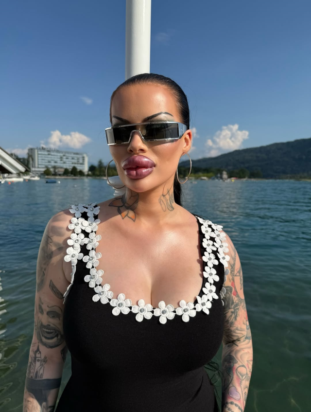 Estetiğe 60 bin dolar harcayan fenomen: Artık ağzımı kapatamıyorum