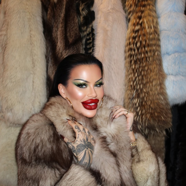 Estetiğe 60 bin dolar harcayan fenomen: Artık ağzımı kapatamıyorum