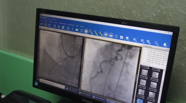 Hastanın kalbine giden kanı akciğere yönlendiren 'anormal damar' operasyonla kapatıldı