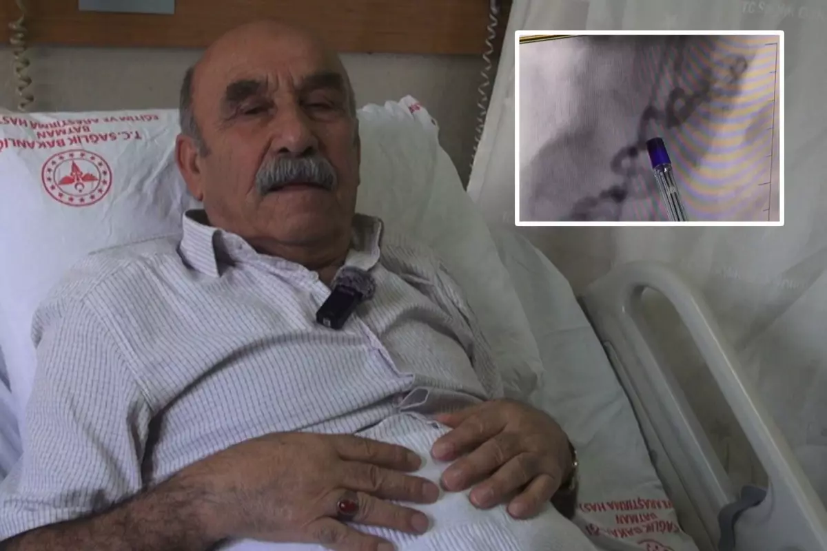 Göğüs yanması şikayetiyle gittiği hastanede kalbinden kan \'çalan\' damar bulundu