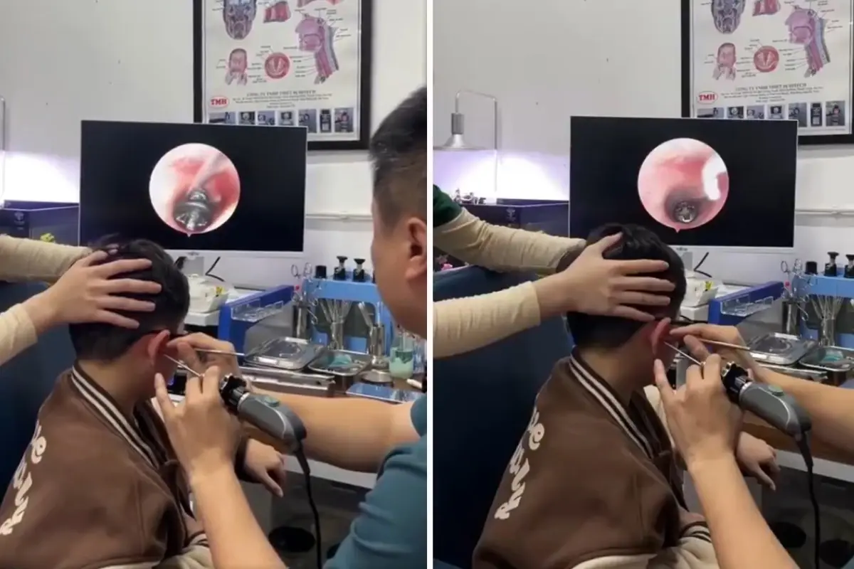 Küçük çocuğun kulağından çıkana, doktorlar bile şaştı kaldı