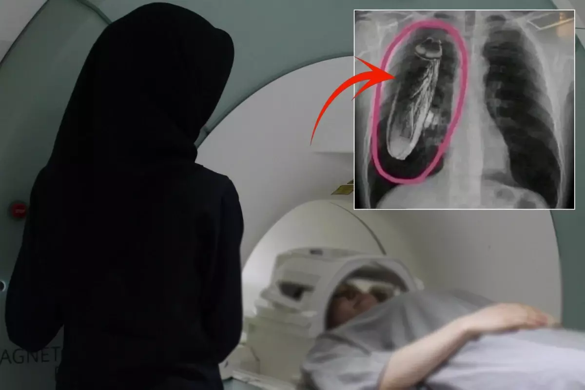 Hastaya \'\'Göğsünde canlı böcek var\'\' dendi, gerçek çok başka çıktı