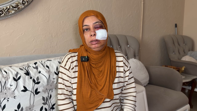 Akraba ziyaretine giderken bu hale geldi Akraba ziyaretine giderken bu hale geldi