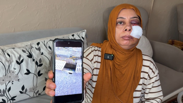 Akraba ziyaretine giderken bu hale geldi Akraba ziyaretine giderken bu hale geldi