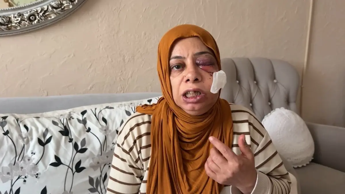 Akraba ziyaretine giderken bu hale geldi