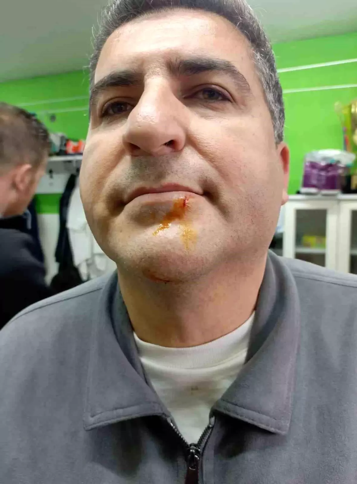 Zonguldak\'ta 3. Lig maçı sonrası gerginlik: 2 gazeteci darbedildi, 2 polis yaralandı