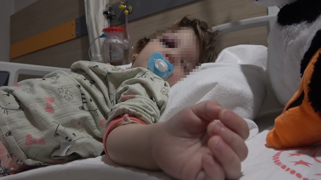 Komşuların gürültü kavgasında 14 aylık bebeğin kafatası çatladı