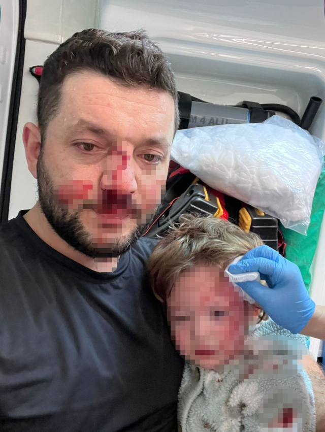 Komşuların gürültü kavgasında 14 aylık bebeğin kafatası çatladı