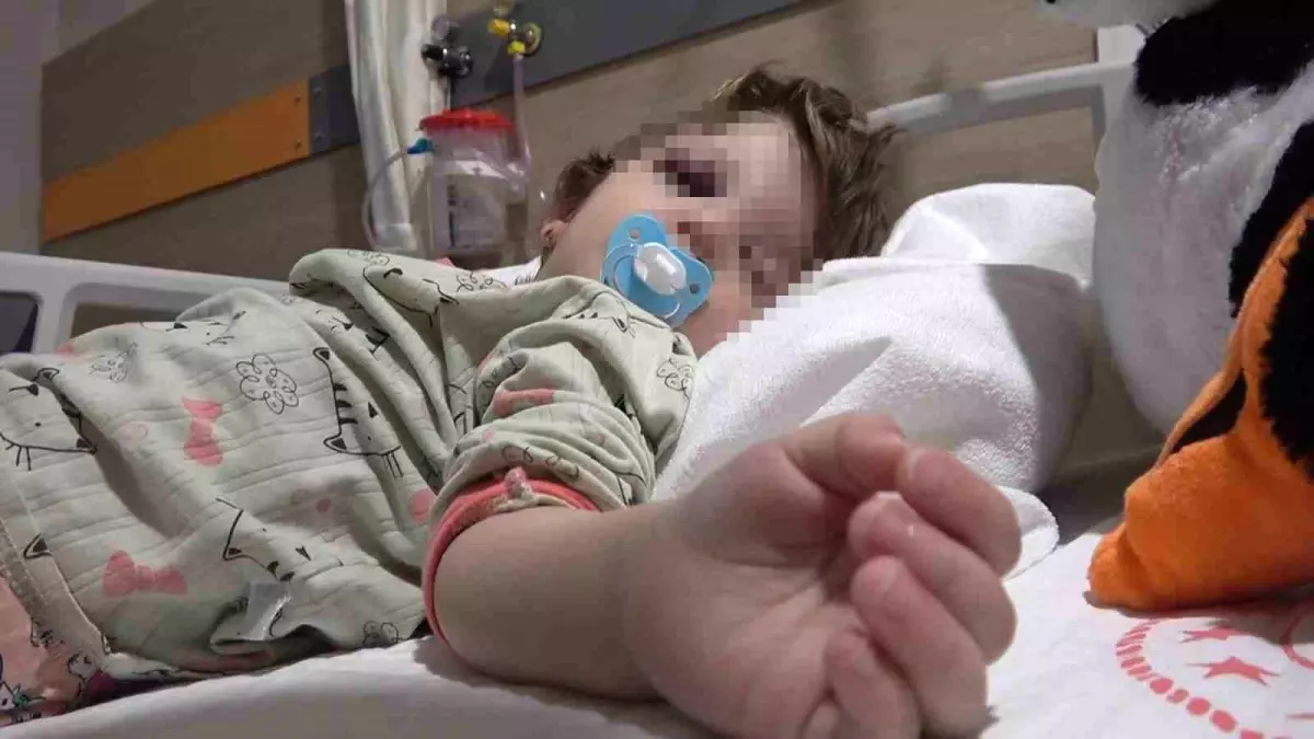 Komşuların gürültü kavgasında 14 aylık bebeğin kafatası çatladı