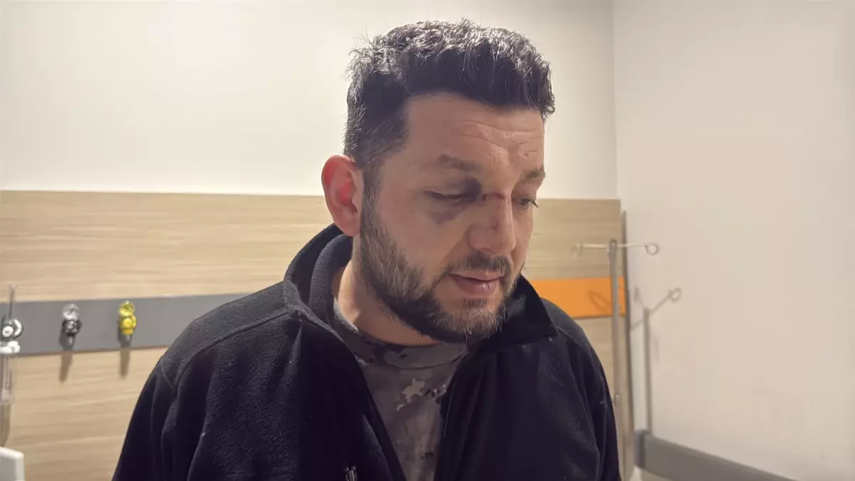 Yalova\'da Bebeğe Darbe İddiası