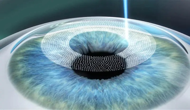 Sağlam Kornea Üzerinde İlaç Geçişi İlk Kez Doğrudan Ölçüldü Sağlam Kornea Üzerinde İlaç Geçişi İlk Kez Doğrudan Ölçüldü